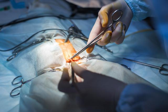 Wie viel kostet eine Vasektomie? Preise im Überblick Wie viel kostet eine Vasektomie? Preise im Überblick