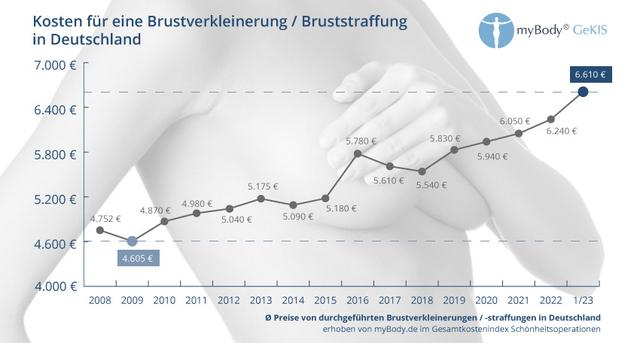 Wie viel kostet eine Brustverkleinerung? Eine genaue Kostenaufstellung Wie viel kostet eine Brustverkleinerung? Eine genaue Kostenaufstellung