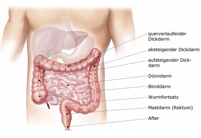 Metastasierter Darmkrebs: Immuntherapie als Zweittherapie bei nicht ansprechendem Tumor Metastasierter Darmkrebs: Immuntherapie als Zweittherapie bei nicht ansprechendem Tumor