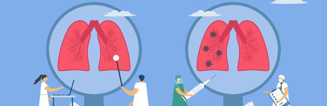 Wie verläuft eine Lungenfibrose und wie endet sie?