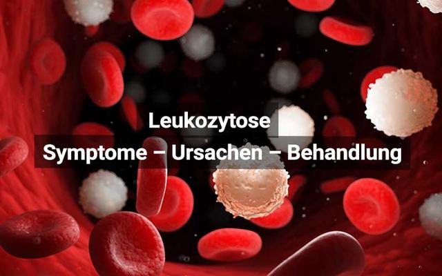 Die Rolle der Ernährung bei erhöhten Leukozytenwerten Die Rolle der Ernährung bei erhöhten Leukozytenwerten