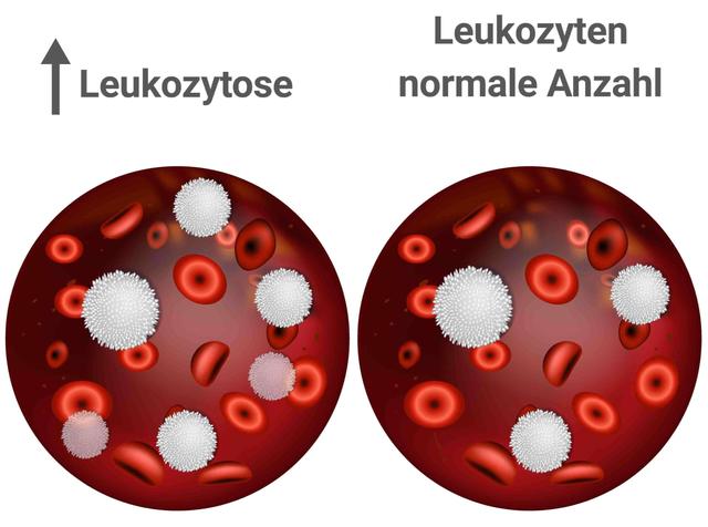 Welche Lebensmittel helfen bei erhöhten Leukozytenwerten? Welche Lebensmittel helfen bei erhöhten Leukozytenwerten?