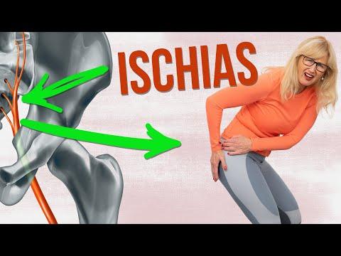 Lumbo-Ischialgie: Wenn Lumbago auf Ischias-Schmerzen trifft Lumbo-Ischialgie: Wenn Lumbago auf Ischias-Schmerzen trifft