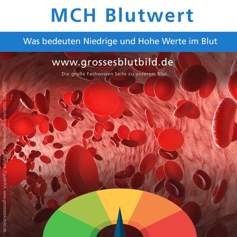 Hohe MCHC-Werte im Blut: Mögliche Sphärozytose-Erkrankung Hohe MCHC-Werte im Blut: Mögliche Sphärozytose-Erkrankung