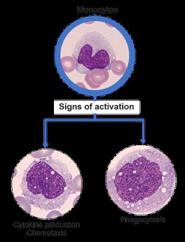 Reaktive Formen der Blutbildveränderungen: Wie ein isolierter Anstieg der Monozyten auf eine Knochenmarkserholung hindeuten kann