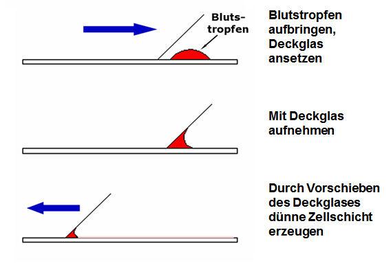 Der Zusammenhang zwischen Monozyten und dem blutbildenden System: Leukämie und andere Erkrankungen