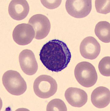 Die Funktion von Monozyten im Immunsystem und ihre Bedeutung für die Infektabwehr