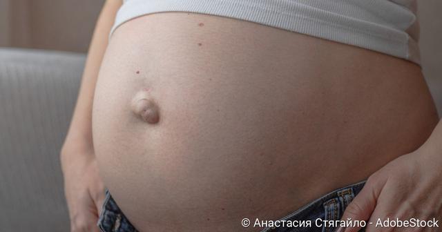 Selbstdiagnose Nabelbruch: Wie Sie ihn eigenständig erkennen Selbstdiagnose Nabelbruch: Wie Sie ihn eigenständig erkennen