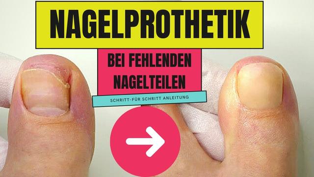 Anleitung: Nagelprothetik selber machen - Schritt für Schritt Anleitung: Nagelprothetik selber machen - Schritt für Schritt
