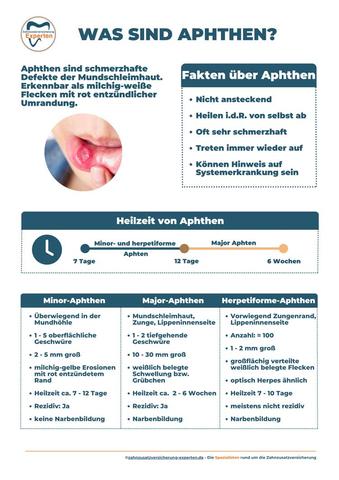 Natürliche Wege zur Heilung von Aphten: Erfahren Sie, was hilft Natürliche Wege zur Heilung von Aphten: Erfahren Sie, was hilft