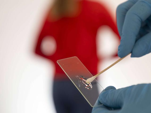 Kritik am neuen Programm aufgrund möglicher später Entdeckung von Gebärmutterkarzinomen