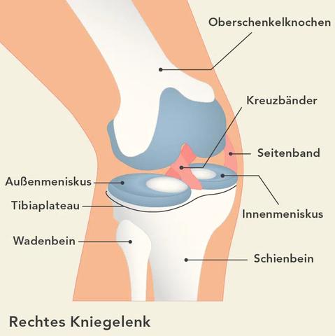 Heilungsprozess nach Meniskusoperation: Wie lange dauern die Schmerzen? Heilungsprozess nach Meniskusoperation: Wie lange dauern die Schmerzen?