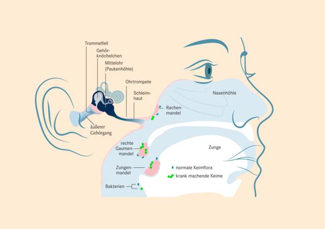 Rechte Ohrenschmerzen: Ursachen und mögliche Bedeutung Rechte Ohrenschmerzen: Ursachen und mögliche Bedeutung