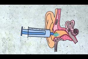 Natürliche Ohrenreinigung: Wie Sie eine schonende Spülung zu Hause durchführen können Natürliche Ohrenreinigung: Wie Sie eine schonende Spülung zu Hause durchführen können