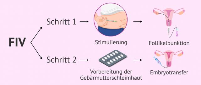 Kryo-Transfer als Alternative zum frischen Transfer: Kryo-Transfer als Alternative zum frischen Transfer: