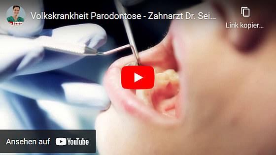 Parodontose-Behandlung: Welche Maßnahmen ergreift der Zahnarzt? Parodontose-Behandlung: Welche Maßnahmen ergreift der Zahnarzt?