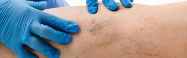 4. Wo finde ich einen Phlebologen in meiner Nähe? Die Arztsuche der Stiftung Gesundheit 4. Wo finde ich einen Phlebologen in meiner Nähe? Die Arztsuche der Stiftung Gesundheit