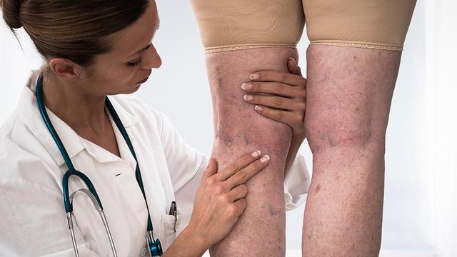 2. Phlebologe werden: Ausbildungsmöglichkeiten und Voraussetzungen 2. Phlebologe werden: Ausbildungsmöglichkeiten und Voraussetzungen