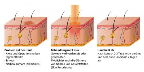 Unangenehmes Pieksen auf der Haut: Mögliche Gründe und Lösungen Unangenehmes Pieksen auf der Haut: Mögliche Gründe und Lösungen