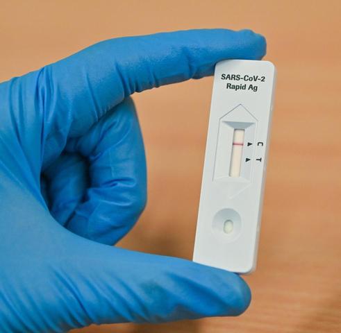 Umgang mit positivem Schnelltest in Hamburg: Aktuelle Informationen