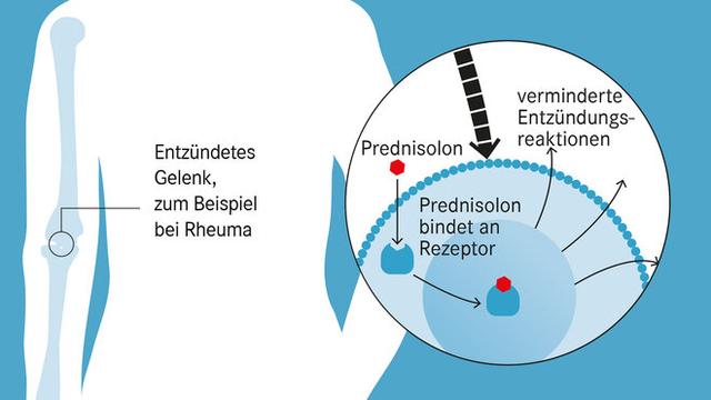 Nebenwirkungen und Wechselwirkungen von Prednison