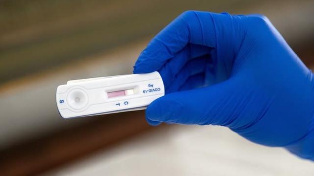 Kostenlose Corona-Tests: Wer kann sich weiterhin kostenlos testen lassen? Kostenlose Corona-Tests: Wer kann sich weiterhin kostenlos testen lassen?
