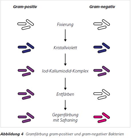 Unterschiede zwischen grampositiven und gramnegativen Bakterien Unterschiede zwischen grampositiven und gramnegativen Bakterien