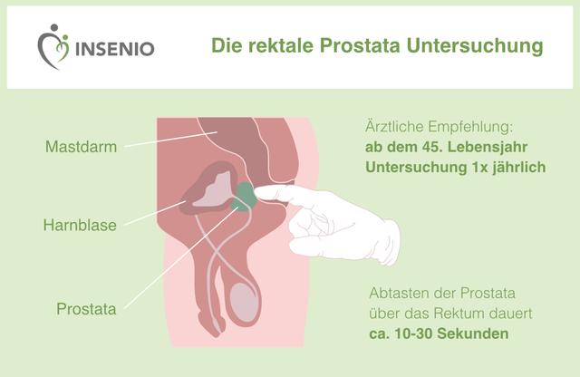 Die optimale Altersgrenze für die Prostata-Vorsorge Die optimale Altersgrenze für die Prostata-Vorsorge