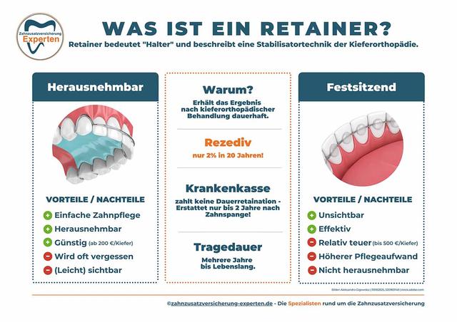 3. "Retainer: Die Bedeutung für eine erfolgreiche kieferorthopädische Behandlung" 3. "Retainer: Die Bedeutung für eine erfolgreiche kieferorthopädische Behandlung"