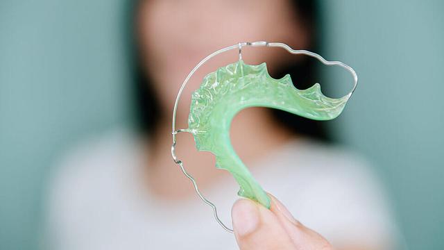 6. "Wie lange sollte ein Retainer getragen werden?" 6. "Wie lange sollte ein Retainer getragen werden?"