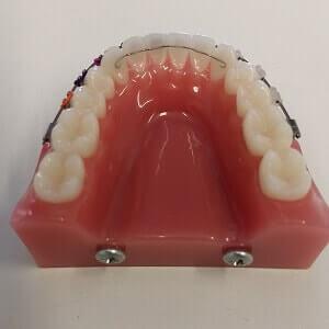 1. "Retainer - Was ist das und wie funktioniert er?" 1. "Retainer - Was ist das und wie funktioniert er?"