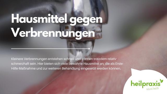 Hausmittel gegen Verbrennungen: Wirksame Methoden zur Linderung