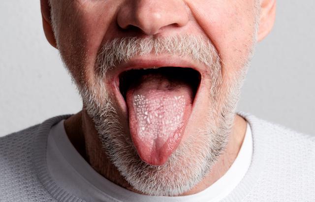 Effektive Maßnahmen gegen Pilzinfektionen im Mund durch die Verwendung von Cortisonspray Effektive Maßnahmen gegen Pilzinfektionen im Mund durch die Verwendung von Cortisonspray