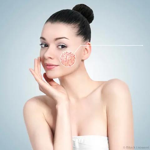 Effektive Methoden zur Behandlung von geplatzten Äderchen im Gesicht zu Hause Effektive Methoden zur Behandlung von geplatzten Äderchen im Gesicht zu Hause