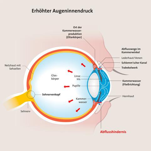 Glaukom und Sehnervschäden: Was tun, wenn der Sehnerv geschädigt ist?