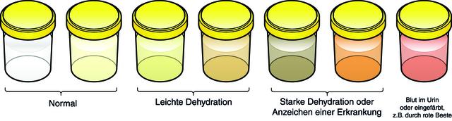 Schäumender Urin: Was sagen die Farbe und Konsistenz aus? Schäumender Urin: Was sagen die Farbe und Konsistenz aus?