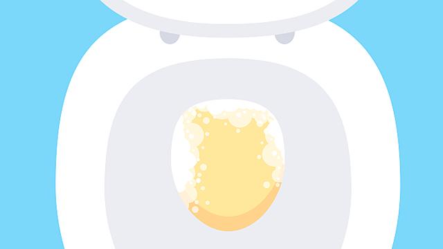 Schäumender Urin: Wann sollte man zum Arzt gehen? Schäumender Urin: Wann sollte man zum Arzt gehen?