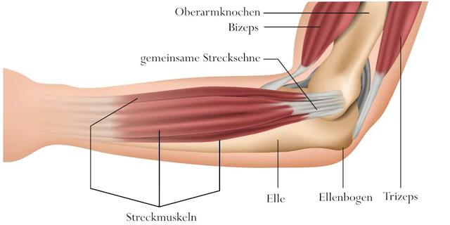 Wenn der Schleimbeutel am Ellenbogen reißt: Schnelle Reaktion und angemessene Therapie