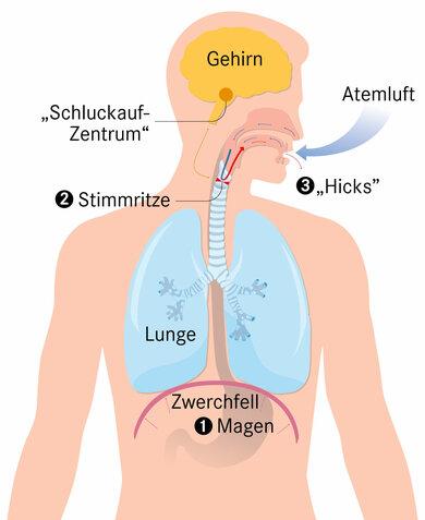 Hilfe, der Schluckauf geht nicht weg! Was kann man tun? Hilfe, der Schluckauf geht nicht weg! Was kann man tun?