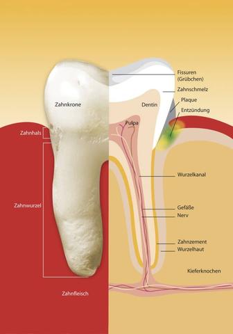 Wurzelkanalbehandlung vor Jahren, aber immer noch Schmerzen: Was hilft? Wurzelkanalbehandlung vor Jahren, aber immer noch Schmerzen: Was hilft?