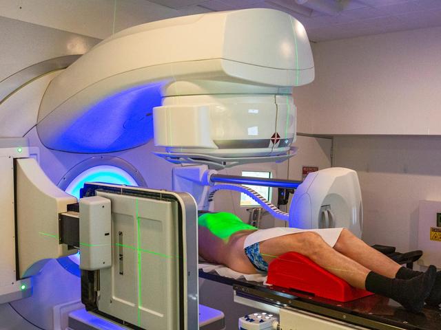 Langzeitfolgen der Bestrahlung: Wie lange halten die Schmerzen an? Langzeitfolgen der Bestrahlung: Wie lange halten die Schmerzen an?