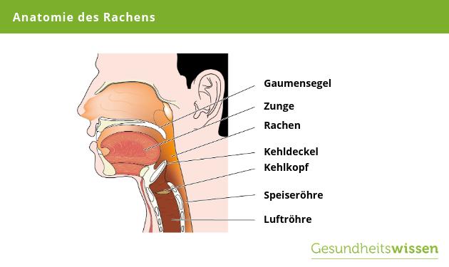 Seitenstrangangina: Symptome, Behandlung und Hausmittel Seitenstrangangina: Symptome, Behandlung und Hausmittel
