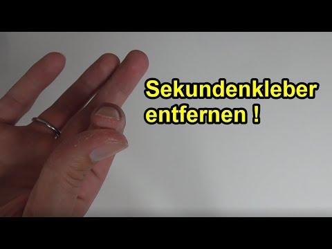 Tipps und Tricks, um Sekundenkleber von der Haut zu entfernen Tipps und Tricks, um Sekundenkleber von der Haut zu entfernen
