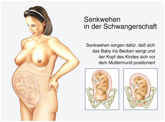 Senkwehen erkennen: Symptome, Dauer und Intensität Senkwehen erkennen: Symptome, Dauer und Intensität