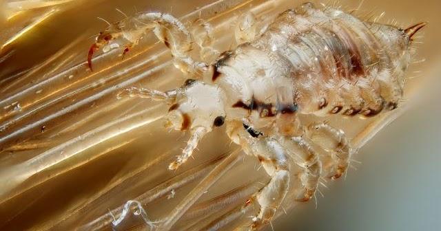 Download und Linktipps zum Thema Kopfläuse und ihre Behandlung Download und Linktipps zum Thema Kopfläuse und ihre Behandlung