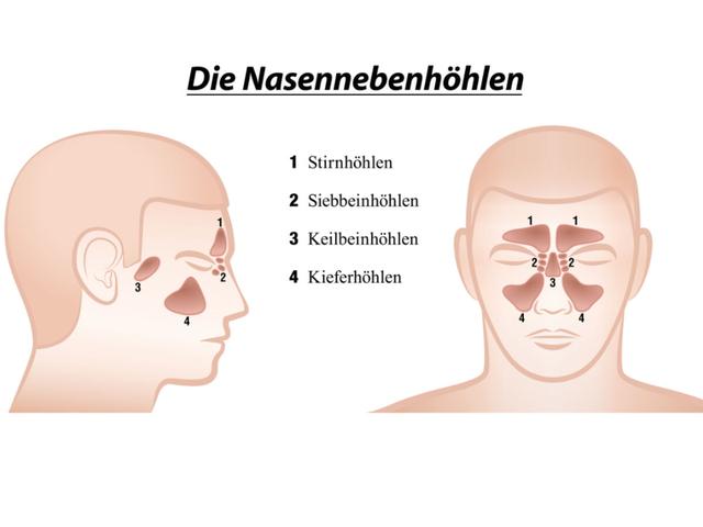 Stinknase: Hintergründe, Behandlungsmöglichkeiten und Vorbeugungstipps Stinknase: Hintergründe, Behandlungsmöglichkeiten und Vorbeugungstipps