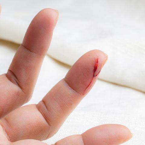 Blutvergiftung erkennen: Symptome und Aussehen Blutvergiftung erkennen: Symptome und Aussehen