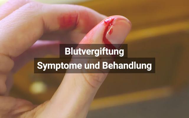 Behandlung einer Sepsis: Therapiemöglichkeiten und Maßnahmen zur Rettung von Leben Behandlung einer Sepsis: Therapiemöglichkeiten und Maßnahmen zur Rettung von Leben