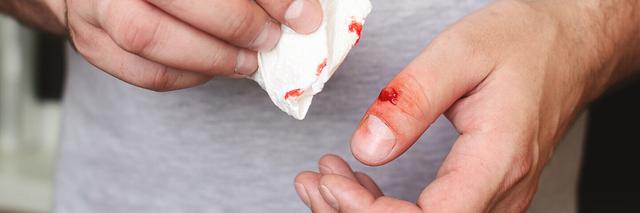 Roter Streifen auf der Haut als Anzeichen für eine Sepsis? Aufklärung und schnelle medizinische Versorgung Roter Streifen auf der Haut als Anzeichen für eine Sepsis? Aufklärung und schnelle medizinische Versorgung