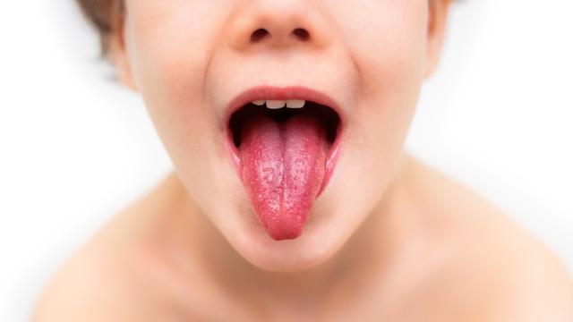 Die verschiedenen Erscheinungsformen von Scharlach im Überblick